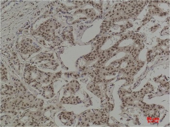 COX2/Cyclooxygenase 2 Mouse mAb Antibody