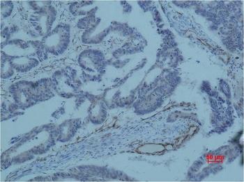 Survivin Mouse mAb Antibody