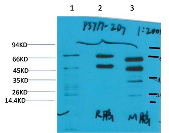 Phosphoserine Mouse mAb Antibody