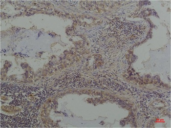 Phosphoserine Mouse mAb Antibody