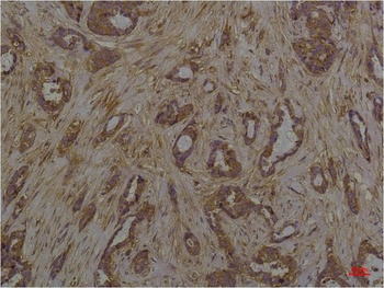 Phosphoserine Mouse mAb Antibody