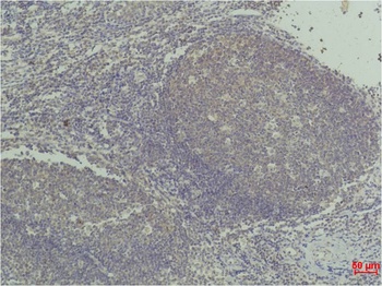TNF α Mouse mAb