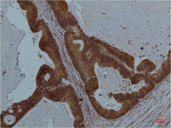 STAT3 Mouse mAb Antibody