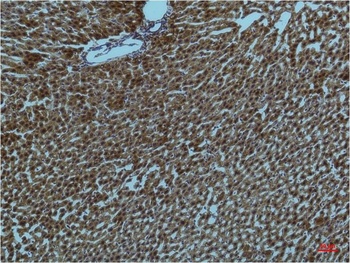 PI3 Kinase P85α Mouse mAb