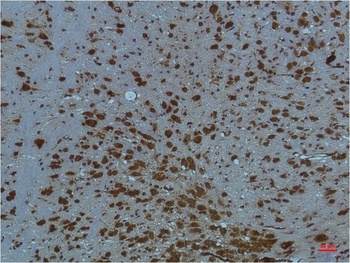 PI3 Kinase P85α Mouse mAb