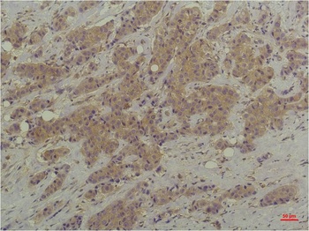 P44/42 MAPK (ERK1/2) antibody