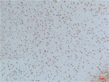 CaMKII beta/gamma/delta (phospho-Thr287) antibody