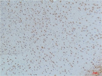 CaMKIIβ/γ/δ (Phospho Thr287) Mouse mAb
