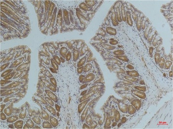 AMPK alpha1 antibody