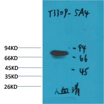 Transferrin Mouse mAb Antibody