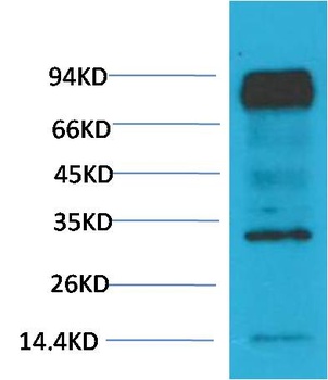 HIF-1 β/ARNT Mouse mAb Antibody