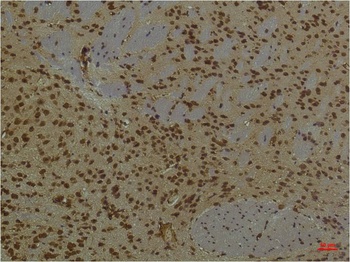 HIF-1 β/ARNT Mouse mAb Antibody
