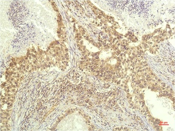 P70 S6 Kinase (1C7) Mouse mAb Antibody