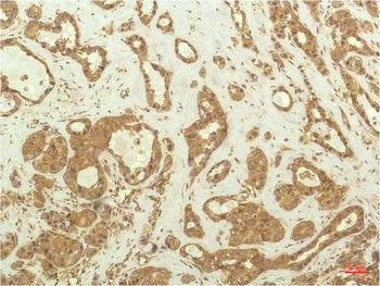 P70 S6 Kinase (1C7) Mouse mAb Antibody