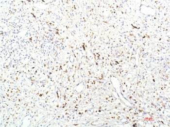 JAK1 (7G6) Mouse mAb