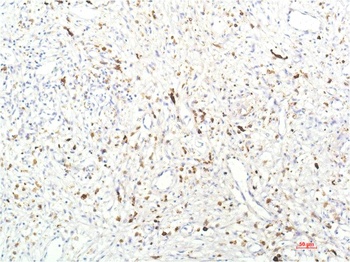 JAK1 antibody