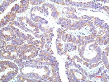 STAT1 (12E8) Mouse mAb