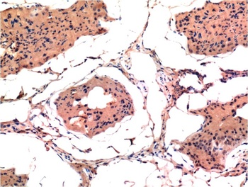 Bax (6F11) Mouse mAb