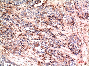 AKT (1H2) Mouse mAb Antibody