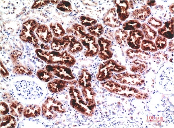 Cystatin C (7F11) Mouse mAb