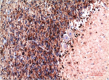 Cystatin C (7F11) Mouse mAb