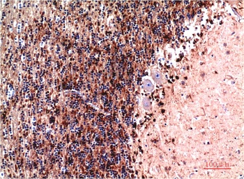 Cystatin C antibody