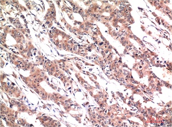 Phospho-Stat3 (Y705) (1E9) Mouse mAb