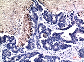 Acetyl-Histone H3 antibody