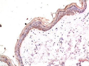 phospho-MLKL (S358) (6B4) Mouse mAb