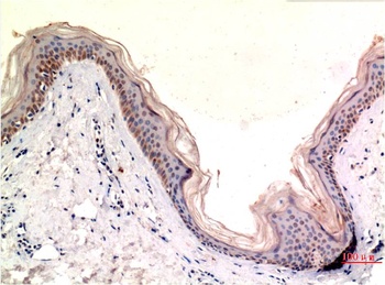 MLKL (8H7) Mouse mAb