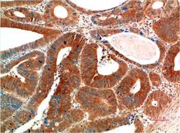 Phospho-ERK 1/2 (Y205/222) (7A6) Mouse mAb