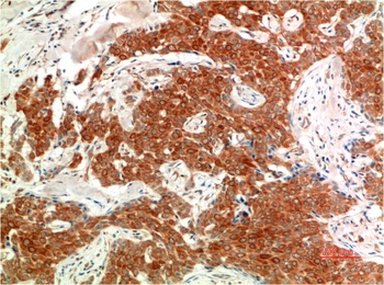 Phospho-ERK 1/2 (Y205/222) (7A6) Mouse mAb