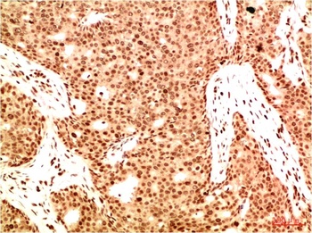 Acetyl NF kB P65(K314/K315) (5G11) Mouse mAb Antibody