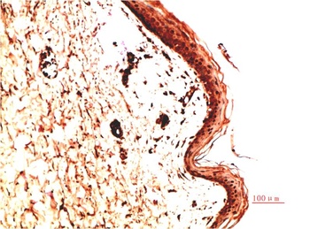 Collagen IV (5C9) Mouse mAb Antibody