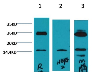 Histone H3 (di methyl K79) antibody