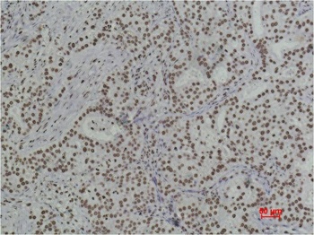 Histone H3 (di methyl K79) antibody