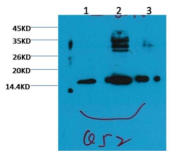 Histone H3 (tri methyl K79) antibody