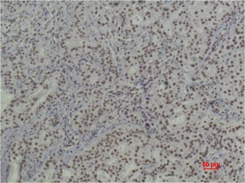 Histone H3 (tri methyl K79) antibody