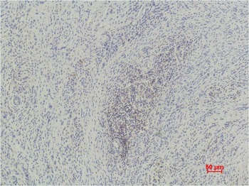 Histone H3 (mono methyl K79) antibody