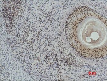 Histone H3(di methyl K9) Monoclonal antibody