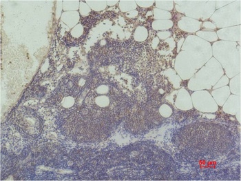 Histone H3(tri methyl K9) Monoclonal antibody