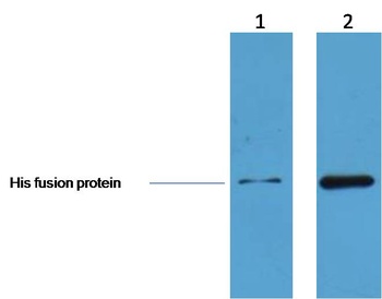 His-Tag antibody