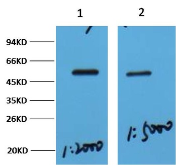 MeCP2 Rabbit pAb Antibody