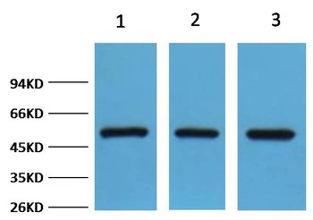 FH/Fumarase Rabbit pAb Antibody