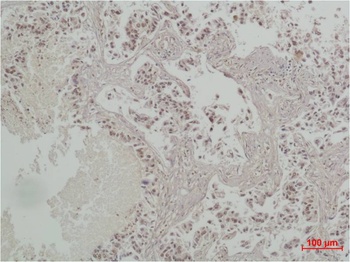 CREB Rabbit pAb Antibody