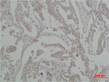 Vinculin antibody