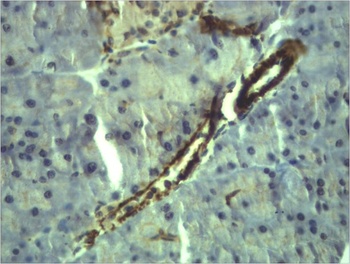 α-Smooth Muscle Actin Rabbit pAb