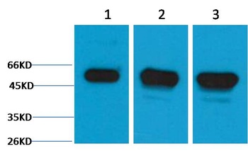 β III Tubulin Rabbit pAb