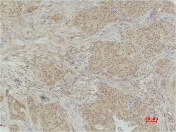 Histone H3(Phospho Thr32 ) Rabbit pAb