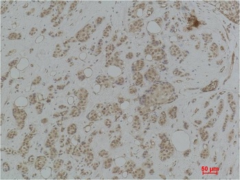 Histone H2B(Tri Methyl Lys43) Rabbit pAb Antibody